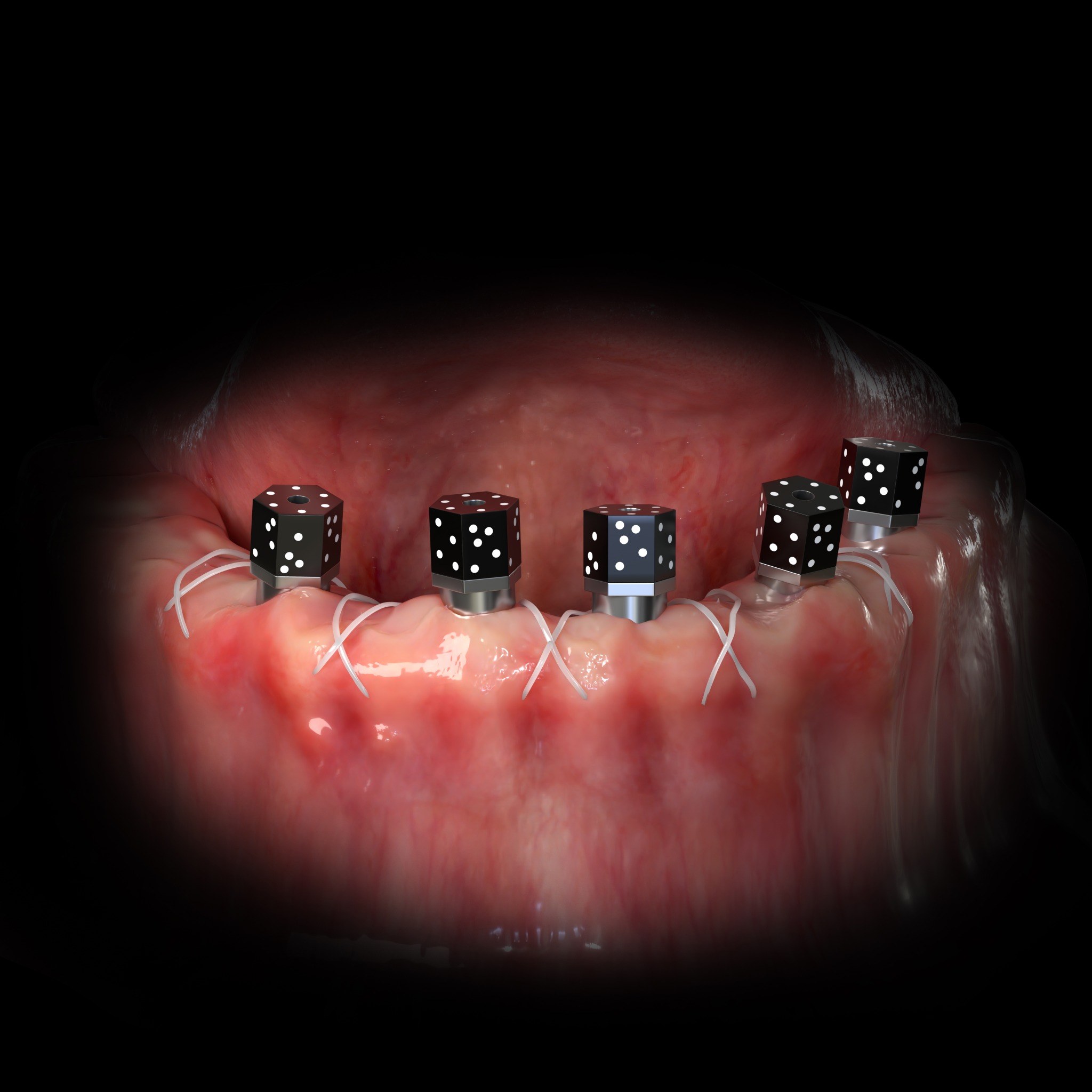 Implant Technology